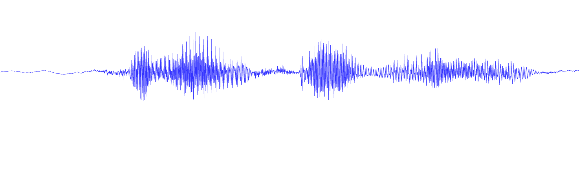 Sound waveform